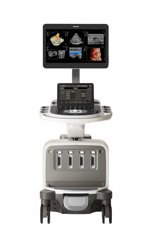 위례장비-Philips-EPIQ-Elite